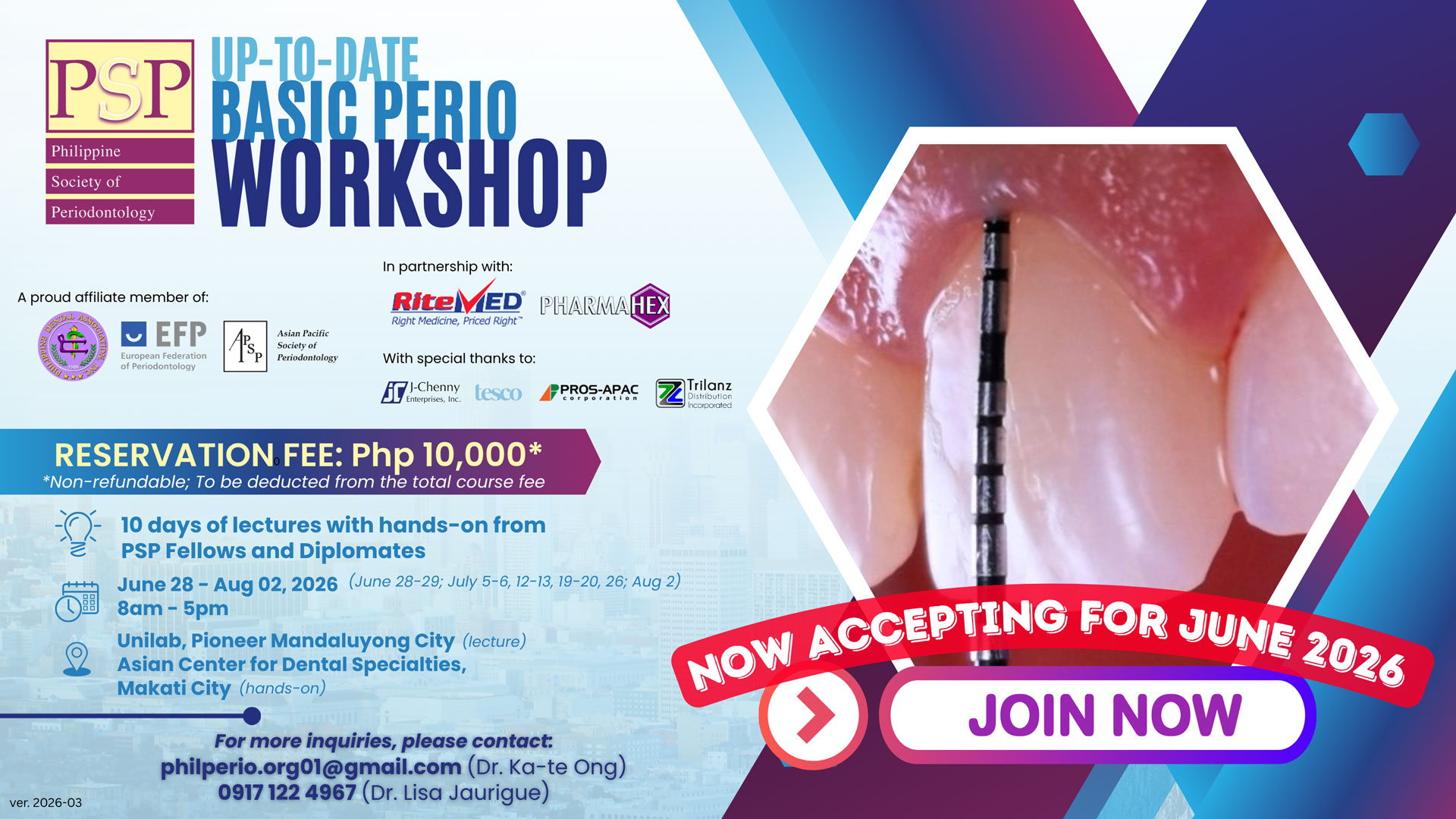 Up-to-Date Basic Perio Workshop 2026